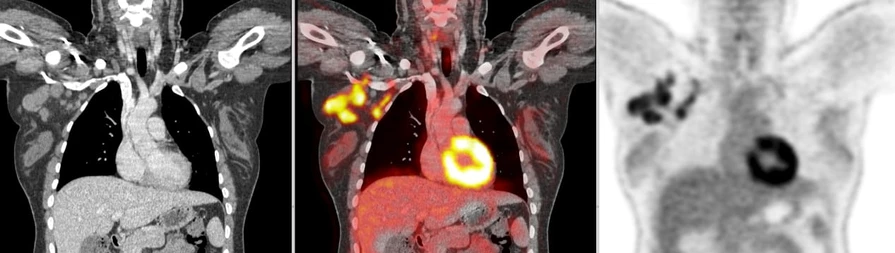 Hi-Definition Hi-Resolution-DR PET/CT images