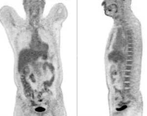 Hi-Definition Hi-Resolution-DR PET/CT images
